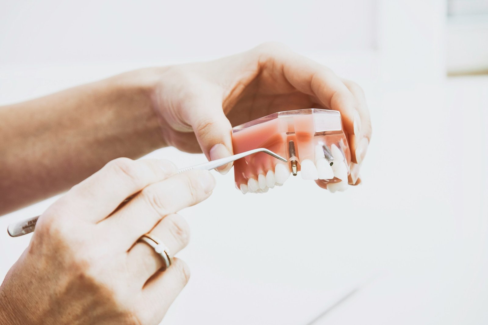 Understanding ClearChoice Dental Implants: A Comprehensive Guide